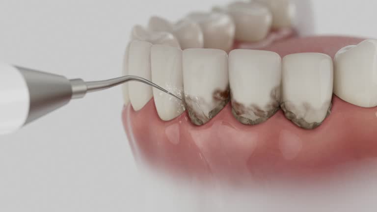 Reliable Dental Implants contractor in Williams, AZ by Smile Center Dentistry